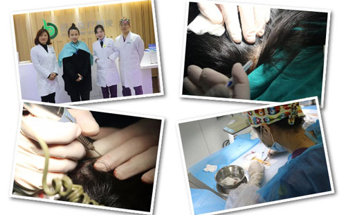 脱发严重，在深圳怎样选择好的植发医院?