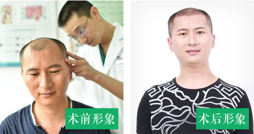 深圳倍生植发医院总院在哪里？