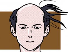 毛发移植技术解决“头发的癌症”